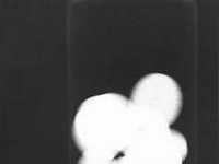 Lanthanum carbonate.JPG